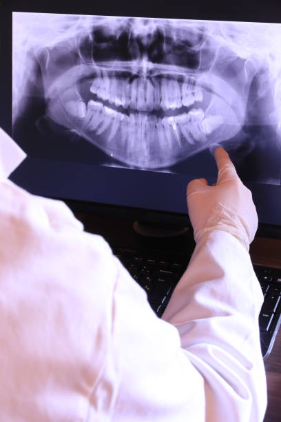 Best Knocked-Out Tooth Emergency  in Aurora, OH