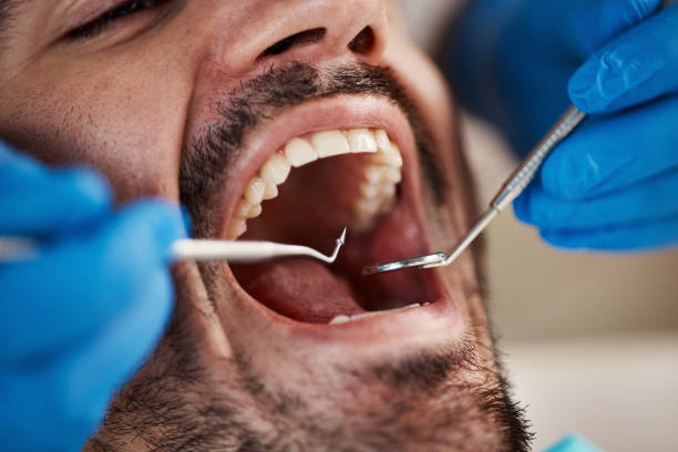 Best Dentist for Tooth Abscess  in Aurora, OH