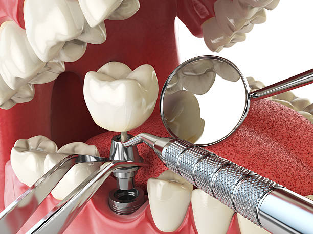 Best Root Canal Emergency Dentist  in Aurora, OH